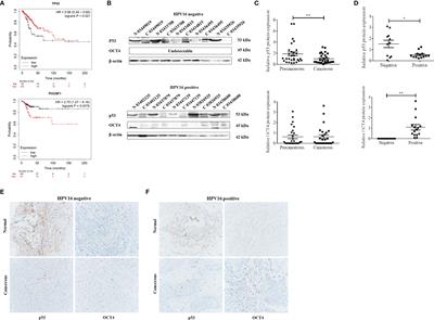 HPV16 E6-Activated OCT4 Promotes Cervical Cancer Progression by Suppressing p53 Expression via Co-Repressor NCOR1